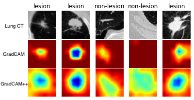 CAM visualization example